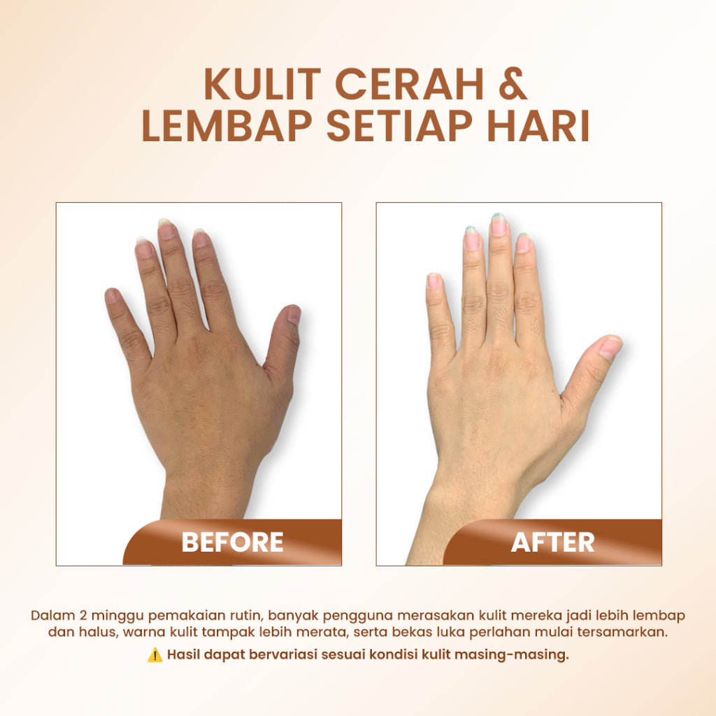 [Promo Special] Cleora Calendula Healthy Bright Body Lotion Handbody Wanita Pria With Niacinamide Brightening Memudarkan Bekas Luka Pereda Eksim Body Butter Skin Care Whitening Lotion Pemutih Seluruh Tubuh BPOM Kosmetik Penghilang Koreng Gelap Tangan Kaki