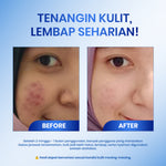 Cleora 4X Hyalu Hydrating Moisturizer - Pelembab Cream Wajah Untuk Memperbaiki Skin Barier Menenangkan & Menghidrasi Kulit Kering Kusam Berminyak