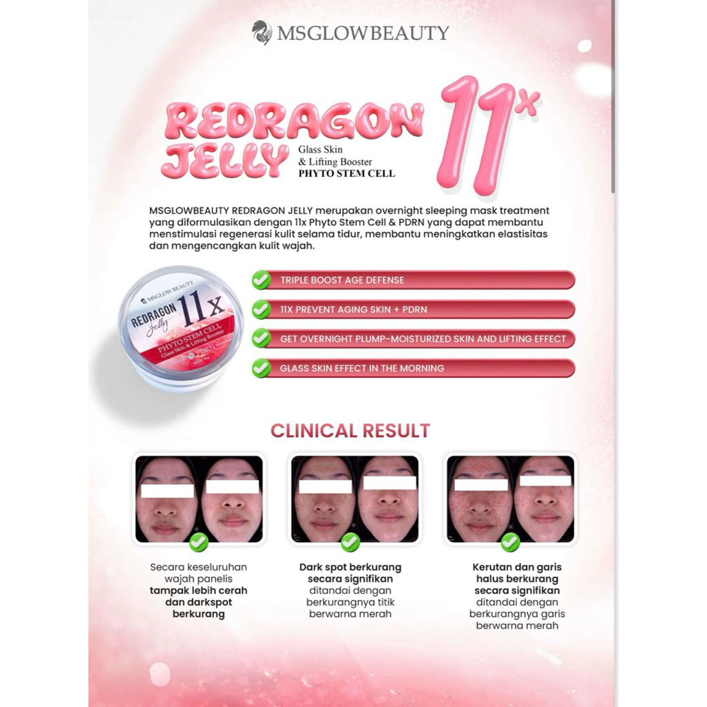 MS GLOW REDRAGON JELLY NEW
