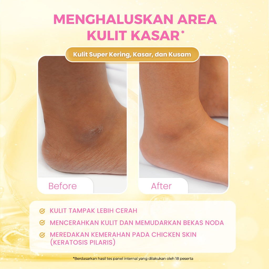 SCARLETT Intense Brightening AHA Body Serum 250ml | 5% AHA BHA PHA Mencerahkan Meratakan Warna Kulit Melembutkan Chicken Skin | Solusi untuk Kulit Belang