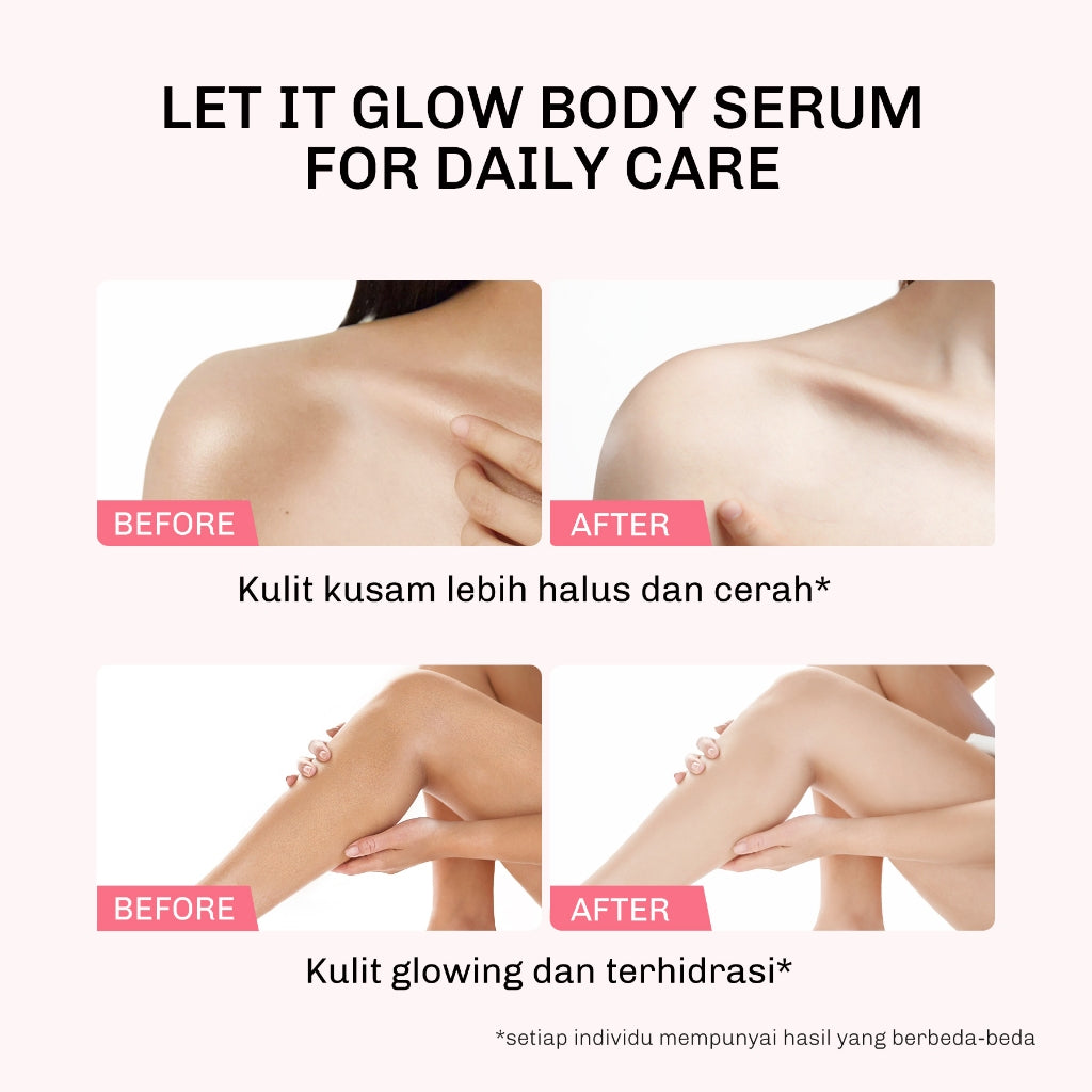 Lavojoy Let It Glow Black Opium Body Serum Skin Brightening Upgraded Version | Body Lotion Untuk Mencerahkan Dan Melembabkan Kulit Dengan Niacinamide + Ceramide + Vitamin E