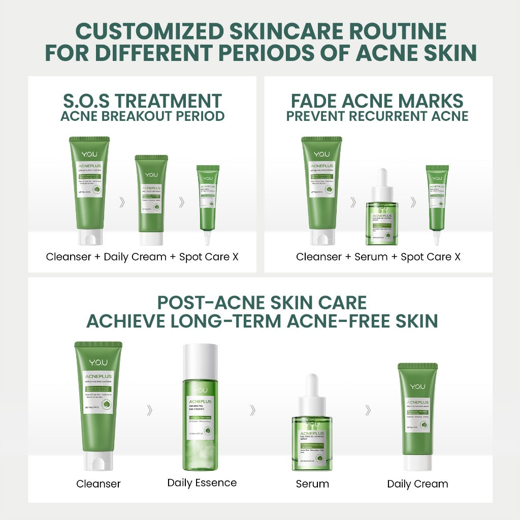 YOU AcnePlus Oil Control Clay Mask Masker Jerawat Masker Komedo Kulit Berminyak Bebas Jerawat