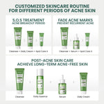 YOU AcnePlus Oil Control Clay Mask Masker Jerawat Masker Komedo Kulit Berminyak Bebas Jerawat