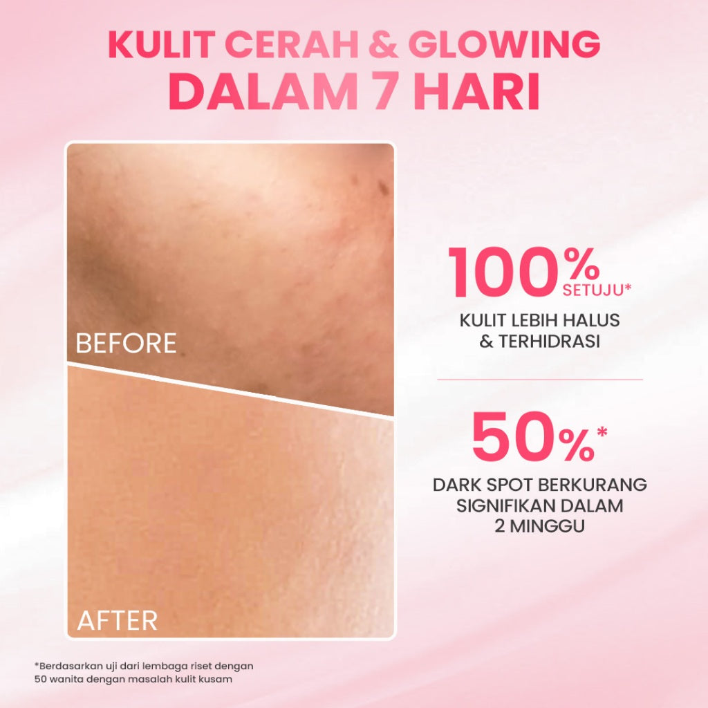 [Special Package] Hanasui Double Expert, Glow Better Set 4 pcs + Power Bright Expert Serum - Real 10% Advance Nianicinamide Menyamarkan Bintik Hitam Bekas Jerawat New Improved Formula