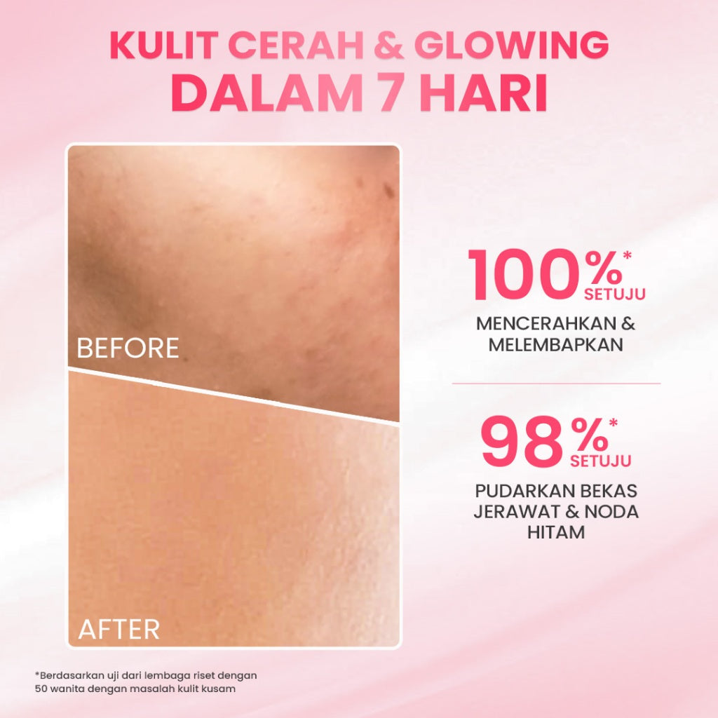 Hanasui Glow Expert Toner Essence New Improved Formula - Hidrasi Maksimal Mencerahkan & Menghaluskan - Niacinamide & Genowhite