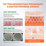 [NEW UPGRADED] YOU AcnePlus Spot Care Pro Serum Obat Totol Jerawat B5 Barrier Moisturizer Gel Obat Bekas Jerawat Kulit Sensitif Kulit Berjerawat [Hot Selling]