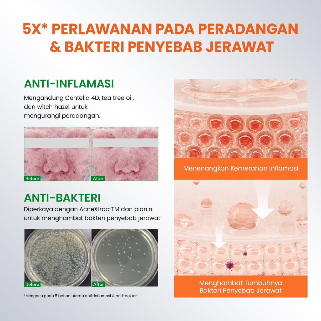 [NEW UPGRADED] YOU AcnePlus Spot Care Pro Serum Obat Totol Jerawat B5 Barrier Moisturizer Gel Obat Bekas Jerawat Kulit Sensitif Kulit Berjerawat [Hot Selling]