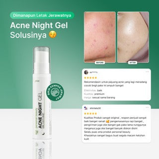 Personal Beauty Acne Night Gel Terapi Peradangan Jerawat Anti Bacterial Exfoliating