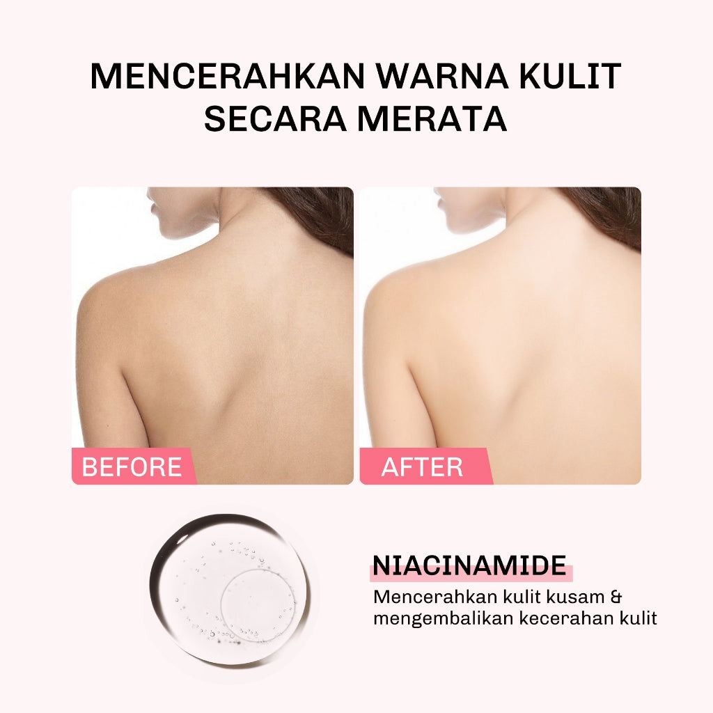 Lavojoy Let It Glow Black Opium Body Serum Skin Brightening Upgraded Version | Body Lotion Untuk Mencerahkan Dan Melembabkan Kulit Dengan Niacinamide + Ceramide + Vitamin E