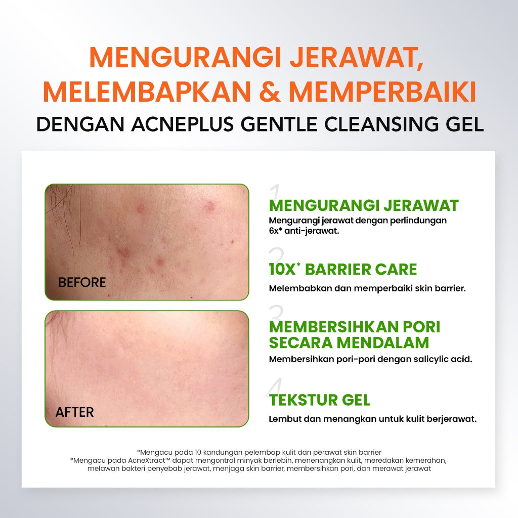 YOU AcnePlus Gentle Gel Cleanser Sabun Cuci Muka Jerawat Kulit Berminyak Berjerawat Salicylic Acid Face Wash