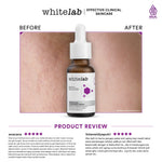 Whitelab Bakuchiol Treatment Serum - Atasi Jerawat dan Bruntusan Alternatif Retinol dengan Bakuchiol & Hyaglutamic [BPOM]