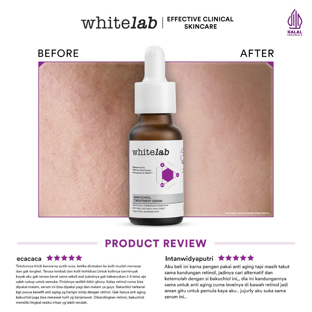 Whitelab Bakuchiol Treatment Serum - Atasi Jerawat dan Bruntusan Alternatif Retinol dengan Bakuchiol & Hyaglutamic [BPOM]