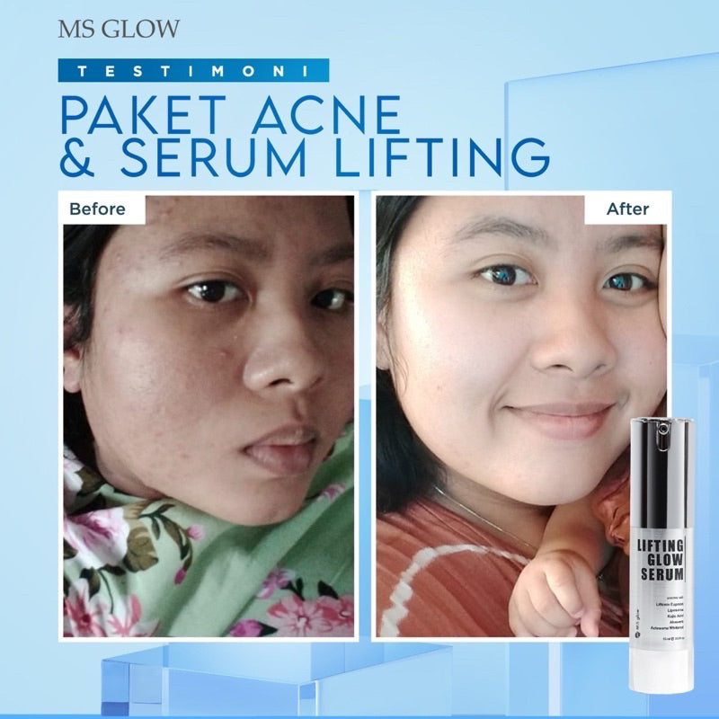 Serum MS glow