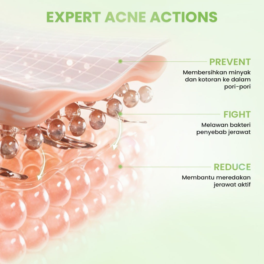 Hanasui Acne Expert Gentle Cleanser  Sabun Busa Lembut Mengurangi Jerawat Tanpa Rasa Ketarik - Salicylic Acid Centella Panthenol