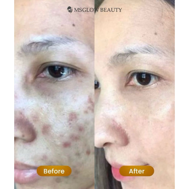 Elixir Booster MS GLOW / Retiglow /  vit C /  Niacinemide / Retinol