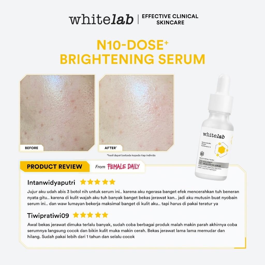 [UPGRADED FORMULA] Whitelab N10-Dose+ Intense Brightening Serum Niacinamide 10% - Serum Pencerah Wajah Intensif Dengan Niacinamide, Oxy229, & Hyaluronic [BPOM]]