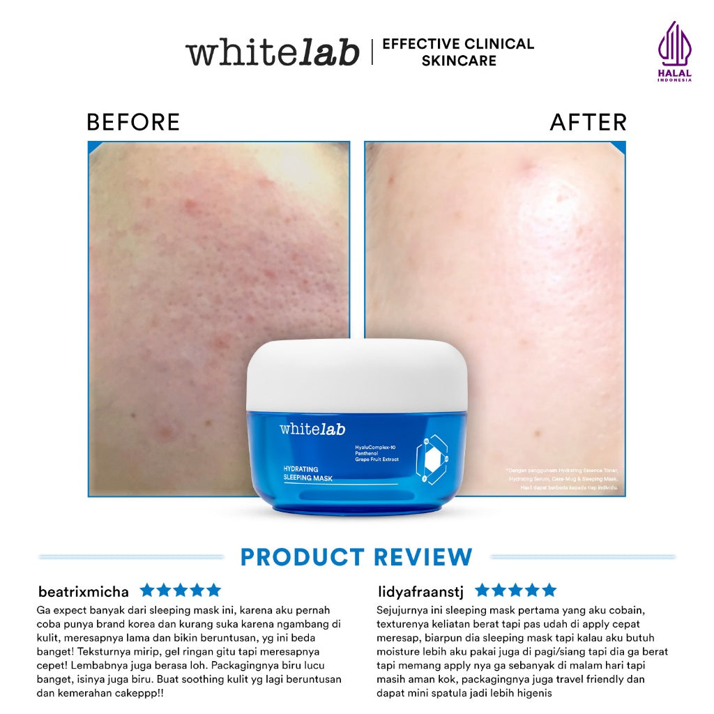 Whitelab Hydrating Sleeping Mask - Pelembap Malam untuk Kulit Lembap, Kenyal, Terhidrasi Maksimal dengan Hyaluronic, Panthenol & Grape Fruit Extract [BPOM]