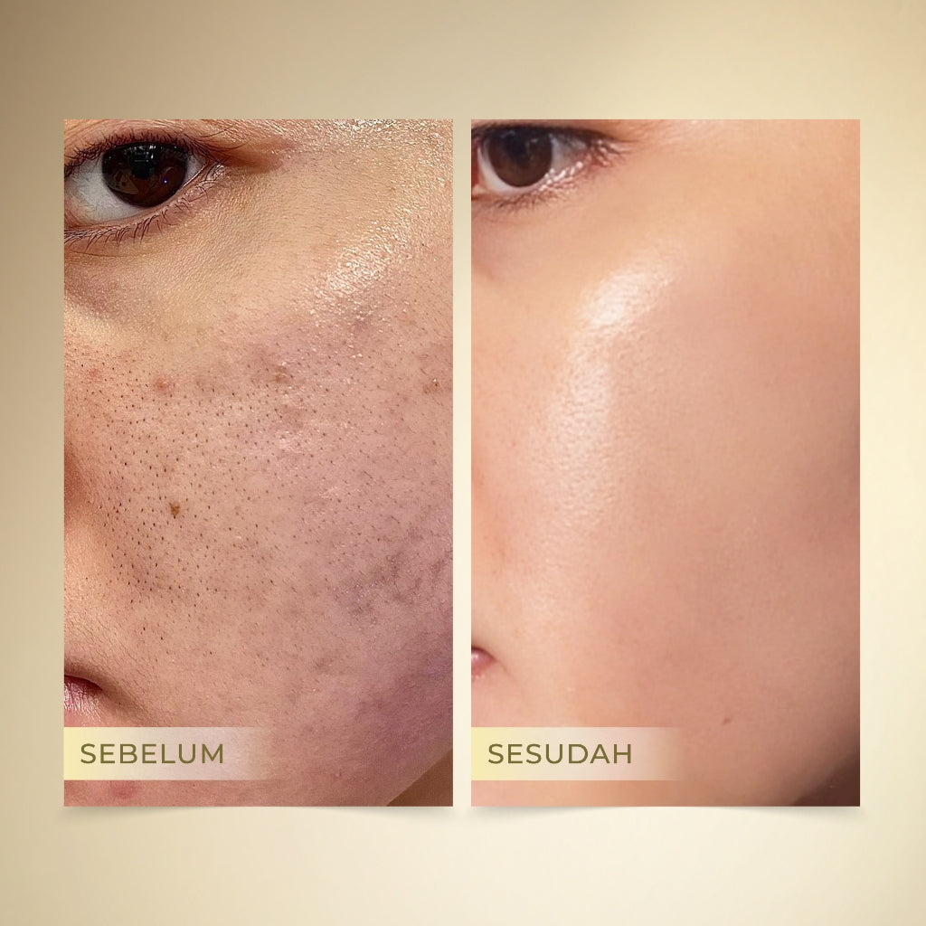 Glowsicha - Brightening Essence Toner Wajah Niacinamide Rose Mencerahkan Melembabkan Hydrating Brightening Skincare Glowing Kulit Serum Hydrating Moisturizing Toner Whitening Kulit Lembab Segar Anti Kusam Skin Prep Toner Glow