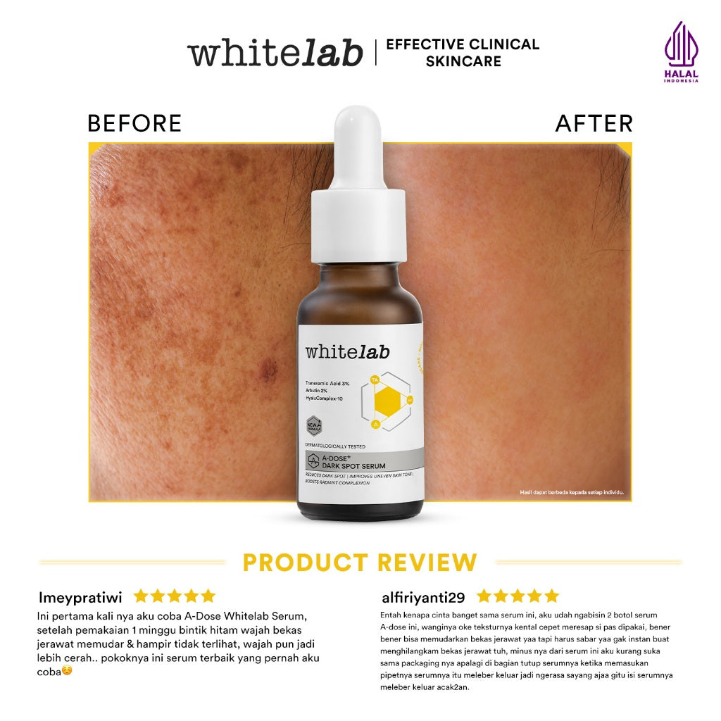 Whitelab Serum Arbutin Anti Dark Spot Flek Hitam - Serum Glowing Pencerah Wajah Bekas Jerawat