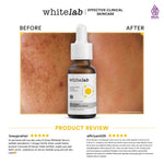 Whitelab Serum Arbutin Anti Dark Spot Flek Hitam - Serum Glowing Pencerah Wajah Bekas Jerawat