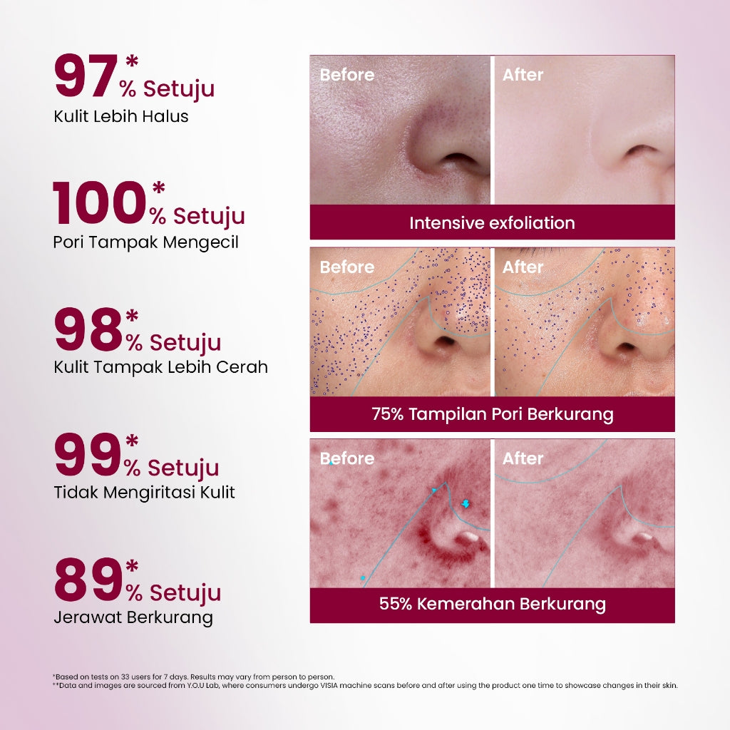 YOU 12% ACID INTENSIVE PEELING SERUM AHA BHA PHA Serum Eksfoliasi Untuk Kulit Cerah dan Halus