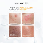 NEWLAB Acnalogy Powder Drink | Acne Drink | Minuman Obat Jerawat untuk Meredakan Bekas Jerawat dan Flek Hitam BPOM 15 Sachet