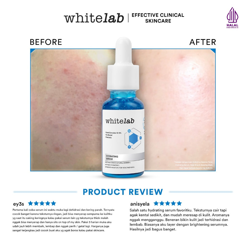 [BUY 1 GET 1] Whitelab Hydrating Serum - Serum Kulit Kering Perkuat Hidrasi untuk Kulit Lembap, Halus & Kenyal dengan Hyaluronic, Panthenol & Probiotic [BPOM]