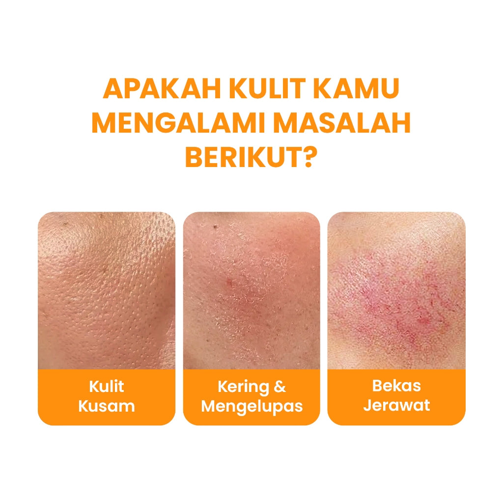 YOU Hy! Amino Glo-Win Brightening Facial Wash Mencerahkan Niacinamide Glowing Skin