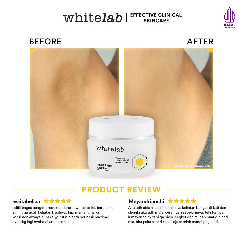 Whitelab Underarm Cream - Krim Pencerah Ketiak Selangkangan Bokong dan Lipatan Kulit Tubuh dengan Niacinamide, Hyaluronic & Collagen [BPOM]