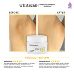 Whitelab Underarm Cream - Krim Pencerah Ketiak Selangkangan Bokong dan Lipatan Kulit Tubuh dengan Niacinamide, Hyaluronic & Collagen [BPOM]