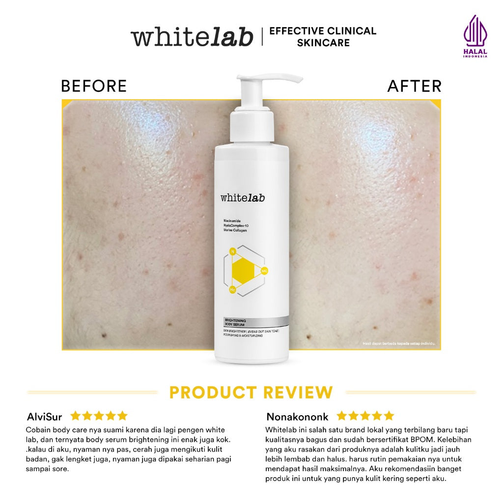 Whitelab Brightening Body Serum - Pelembap Pencerah Kulit Badan dengan Niacinamide, Hyaluronic & Collagen [BPOM]