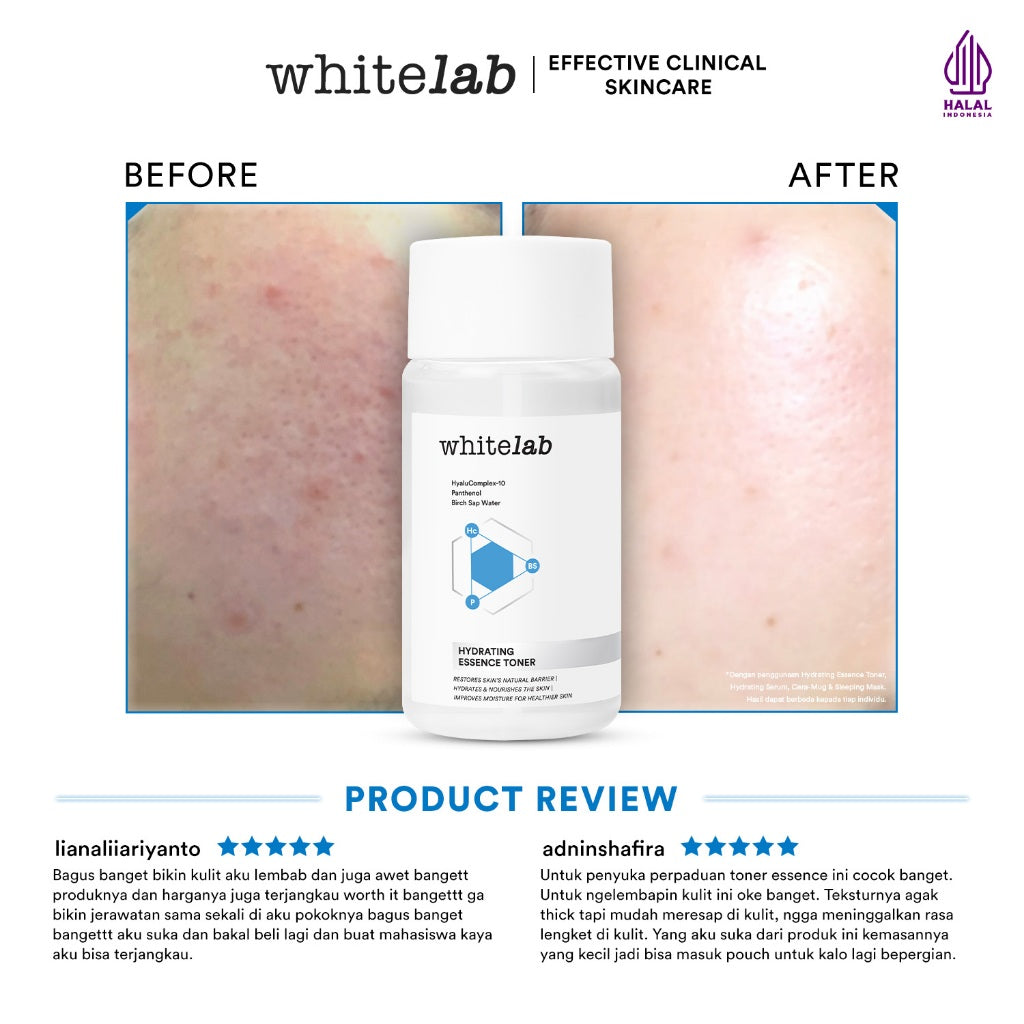 [BUY 1 GET 1] Whitelab Hydrating Essence Toner - Toner untuk Kulit Terhidrasi, Lembap, Kenyal dengan Hyaluronic & Panthenol [BPOM]