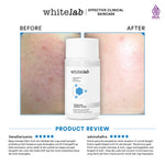 [BUY 1 GET 1] Whitelab Hydrating Essence Toner - Toner untuk Kulit Terhidrasi, Lembap, Kenyal dengan Hyaluronic & Panthenol [BPOM]