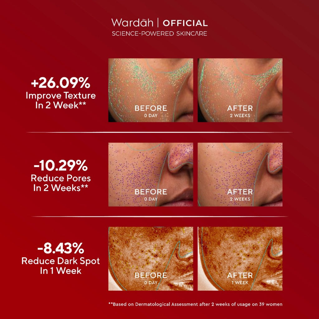 Wardah Exfo Peeling Serum 5% Glycolic Acid 3% Maltobionic Acid 2% Succinic Acid Micro - Serum Exfoliasi Wajah, Serum Membantu Mencerahkan dan Menghaluskan Wajah - Skincare