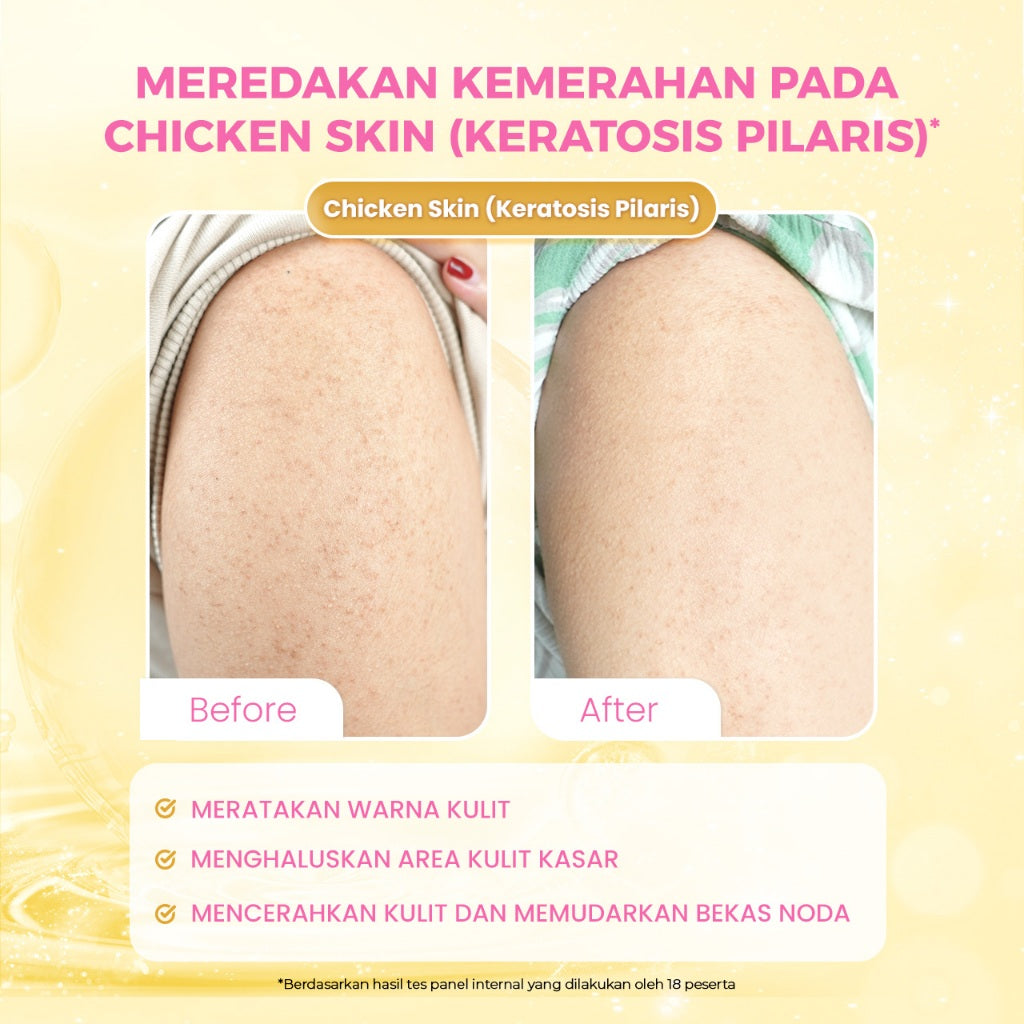 SCARLETT Intense Brightening AHA Body Serum 250ml | 5% AHA BHA PHA Mencerahkan Meratakan Warna Kulit Melembutkan Chicken Skin | Solusi untuk Kulit Belang