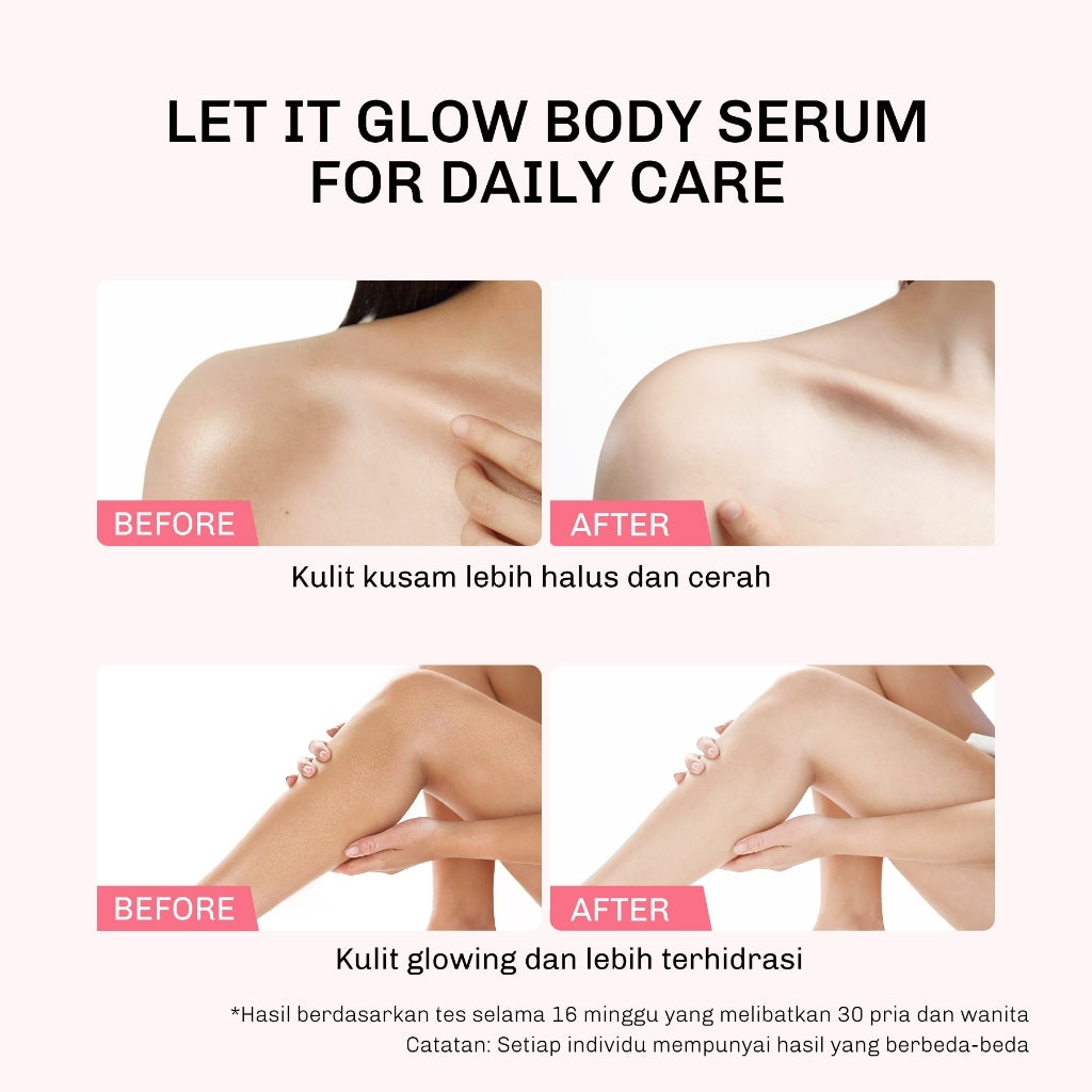 Lavojoy Let It Glow Body Serum Skin Brightening Upgraded Version | Body Lotion Untuk Mencerahkan Dan Melembabkan Kulit Dengan Niacinamide + Ceramide + Vitamin E