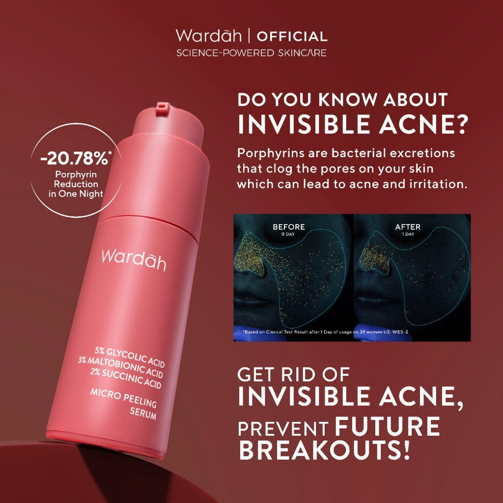 Wardah Exfo Peeling Serum 5% Glycolic Acid 3% Maltobionic Acid 2% Succinic Acid Micro - Serum Exfoliasi Wajah, Serum Membantu Mencerahkan dan Menghaluskan Wajah - Skincare