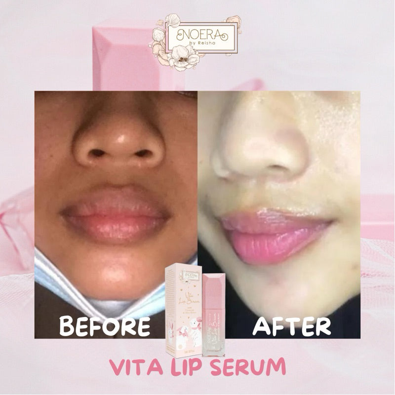 Noera Vita Lip Serum Ceramide & Shea Butter Improved Formula