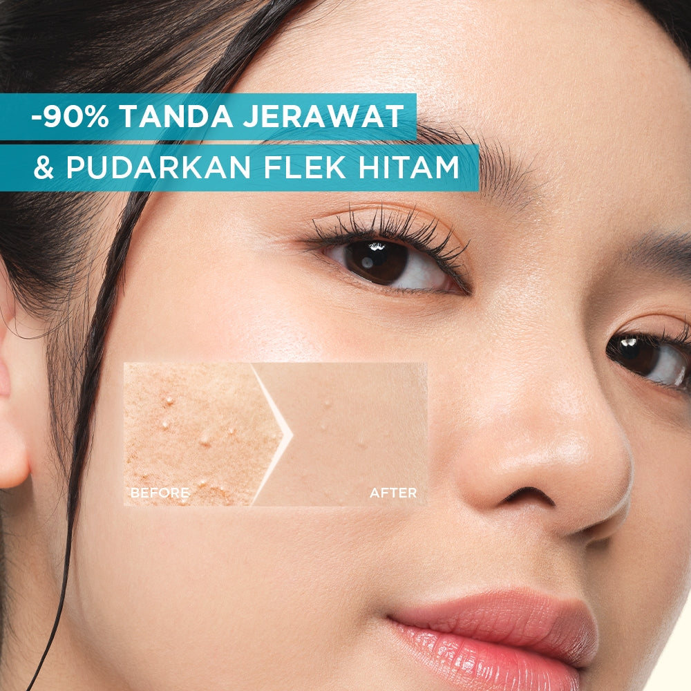 GARNIER Serum Bright Complete Anti Acne Booster Serum Lawan Jerawat 15ml 30ml - Skincare Vitamin C Salycilic Acid Cocok untuk semua jenis kulit