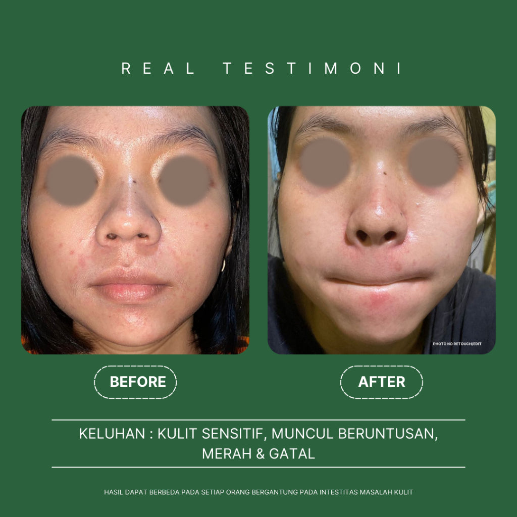 Personal Beauty Soothing Cream - Skin Barier Booster & Calming