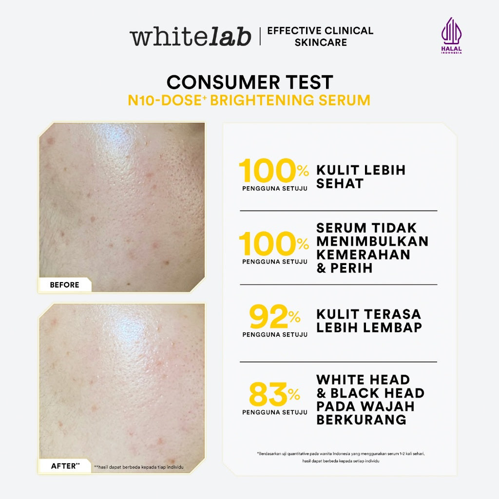 [UPGRADED FORMULA] Whitelab N10-Dose+ Intense Brightening Serum Niacinamide 10% - Serum Pencerah Wajah Intensif Dengan Niacinamide, Oxy229, & Hyaluronic [BPOM]]