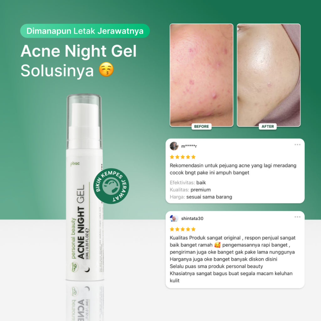 Personal Beauty Acne Night Gel Terapi Peradangan Jerawat Anti Bacterial Exfoliating