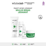 Whitelab Best-Selling Packages - Paket Wajah Brightening, Acne, Hydrating, Anti Aging