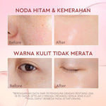Glad2Glow G2G Pomegranate 5% Niacinamide Brightening Moisturizer Pink 30g Pelembab Wajah