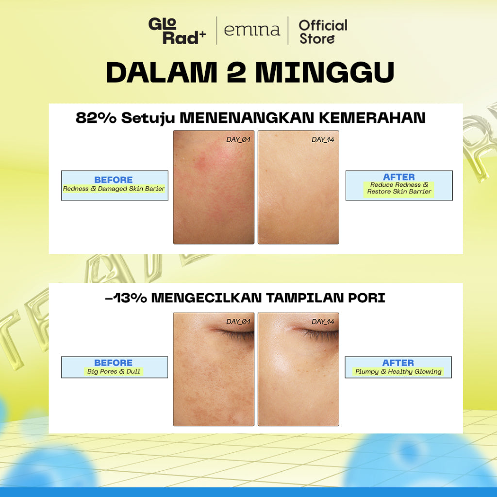 Emina GloRad+ Hyalucica Moisturizer Gel - Pelembab Wajah Glow in The Dark Memperbaiki 5 Level Skin Barrier 10x Glowing Brightening Calming Instant Soothing