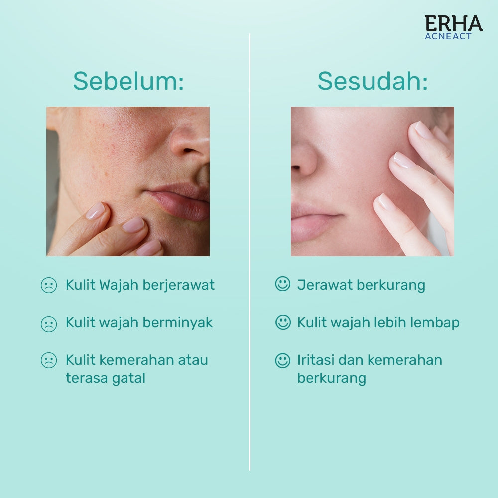 ERHA Acneact AHA BHA & Niacinamide Clarifiying Toner 60ml - Toner Wajah Eksfoliasi  Jerawat & Minyak