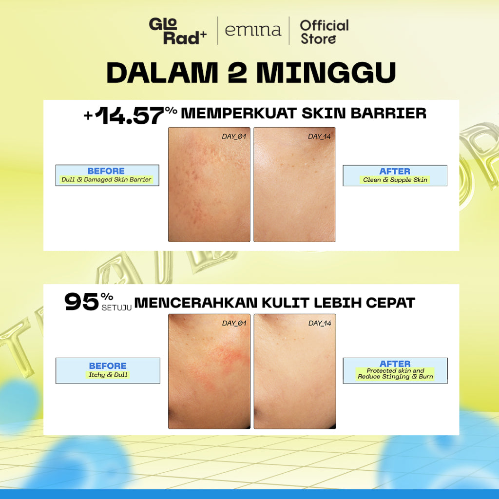 Emina GloRad+ Hyalucica Moisturizer Gel - Pelembab Wajah Glow in The Dark Memperbaiki 5 Level Skin Barrier 10x Glowing Brightening Calming Instant Soothing