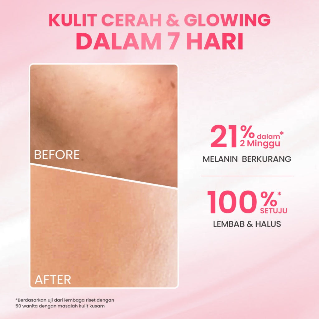 Hanasui Glow Expert Day Cream New Improved Formula - Gel Cream Ringan No Whitecast Mencerahkan & Kurangi Bintik Hitam - Niacinamide & Genowhite