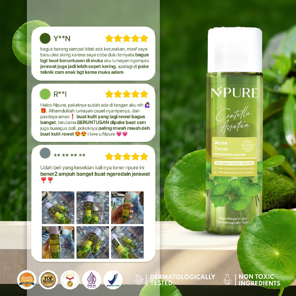 2PCS TONER MOIST - NPURE Acne Face Toner Centella Asiatica 150ml + Acne Clear Barrier Moisturizer Wajah Berjerawat