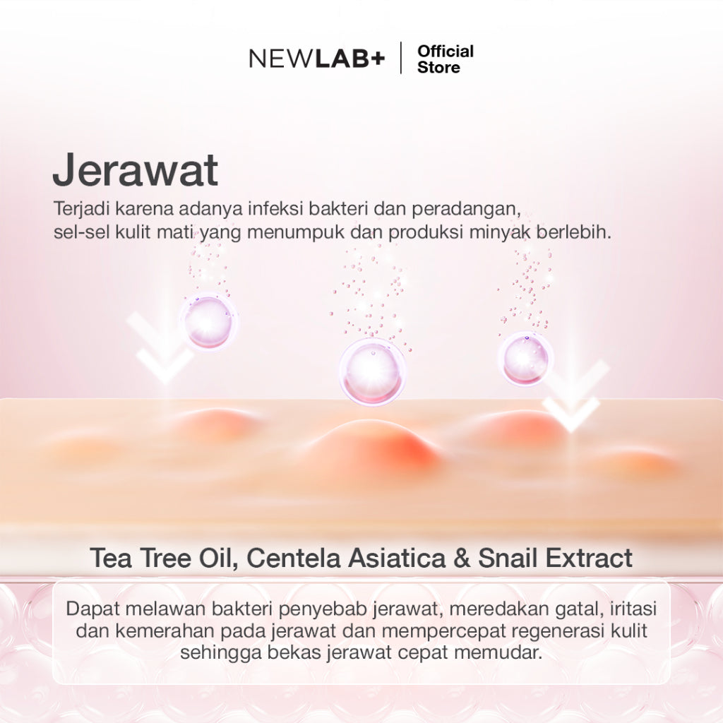 NEWLAB Acnalogy Acne Gel | Obat Totol Jerawat | Salep untuk Jerawat |Meredakan Acne Spot dan Bekasnya 15gr